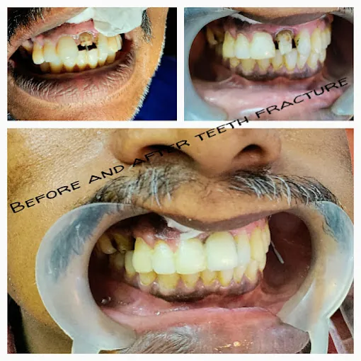 Image of: Veeras Dental Clinic In Arumbakkam