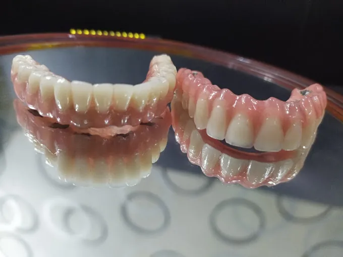Image of: Venkateswara Laser Dental Clinic In Mambalam 3