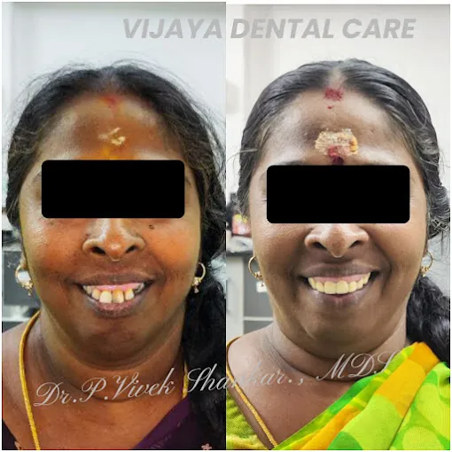 Image of: Vijaya Dental Care And Implant In Perambur