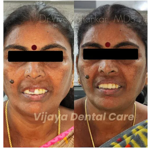 Image of: Vijaya Dental Care And Implant In Perambur 2