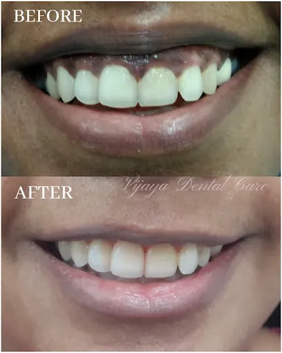 Image of: Vijaya Dental Care And Implant In Perambur 3