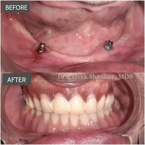 Image of: Vijaya Dental Care And Implant In Perambur