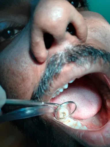 Image of: Vijaya Dental Clinic In Ayanavaram