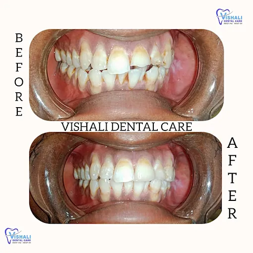 Image of: Vishali Dental Care In Vyasarpadi 5