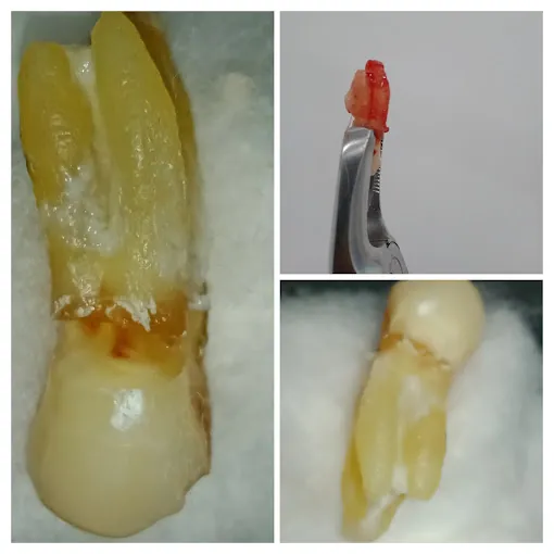 Image of: Vishali Dental Care In Vyasarpadi 7