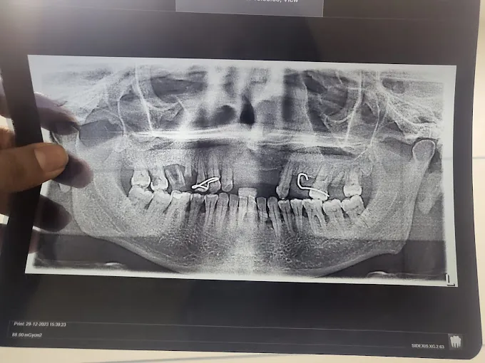 Image of: Vistaa Dental Care And Cosmetic In Perambur