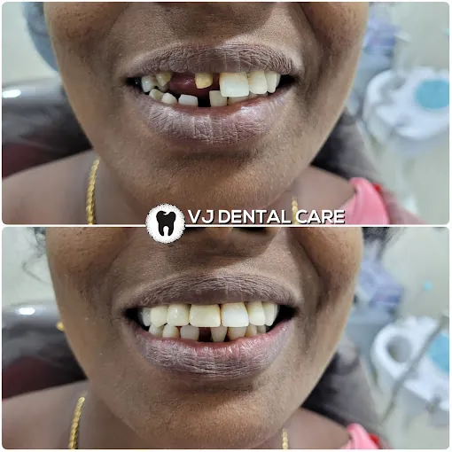 Image of: Vj Dental Care In Tondiarpet