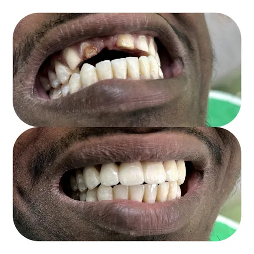 Image of: Yahweh Multispeciality Dental Clinic In Kodungaiyur 2
