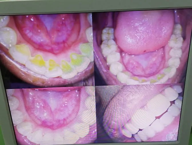 Image of: Yahweh Multispeciality Dental Clinic In Kodungaiyur 3
