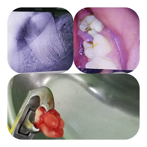 Image of: Yahweh Multispeciality Dental Clinic In Kodungaiyur