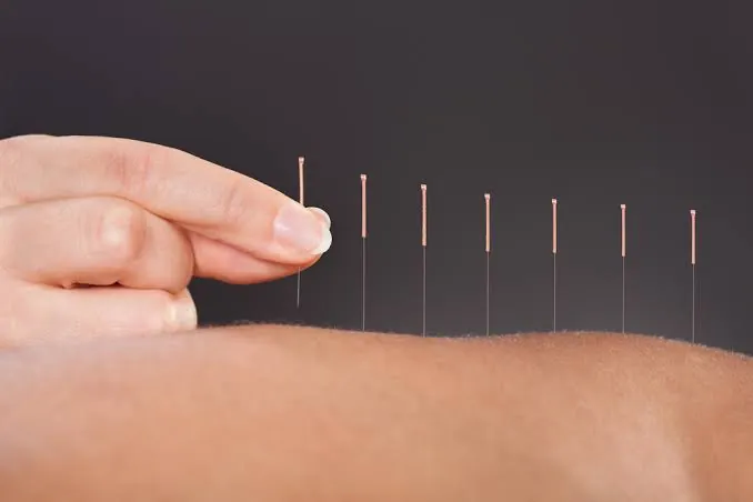 Image of: Zayn Acupuncture And Cupping Clinic In Choolai 2