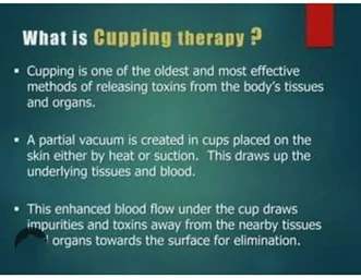 Image of: Al Noor Acupuncture And Varma In Perambur
