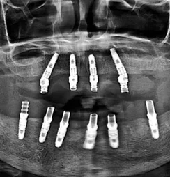 Image of: Best Dental Clinic In T Nagar