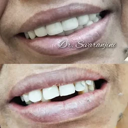 Image of: Bhuvana Dental Clinic In Chennai
