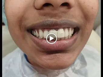 Image of: Dayalan Dental Clinic In Nungambakkam