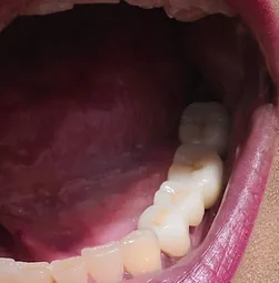 Image of: Dr Amreens Dental Care In Triplicane