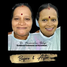 Image of: Drhemamalinis Dental Clinic And Maxillofacial In Triplicane