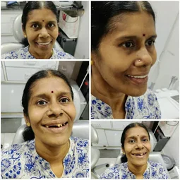 Image of: Drthilagavathis Dental Care In Kodambakkam