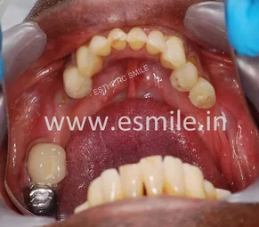 Image of: Estheticsmile Dental Clinic In Nungambakkam