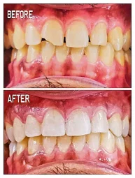Image of: Hemarun Dental Clinic And Lab In Perambur