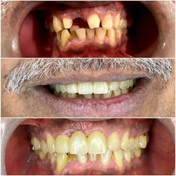 Image of: Impressions Dental Cosmetic And Hair In Mylapore