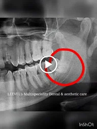 Image of: Leevels Multispeciality Dental And Aesthetic In Arumbakkam