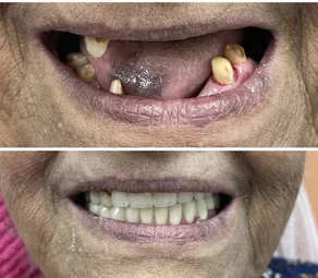 Image of: Metro Dental Care In Saidapet