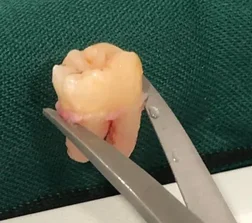 Image of: Orion Dental Care In Nungambakkam