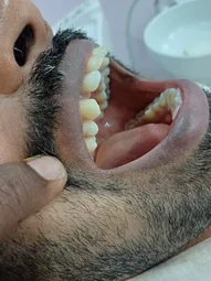 Image of: Sathya Dental Care In Arumbakkam