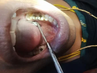 Image of: Shana Dental Care In Aminjikarai