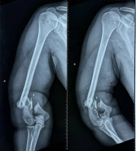 Image of: Atlas Orthocare Clinic By Dr In Ayanavaram 5