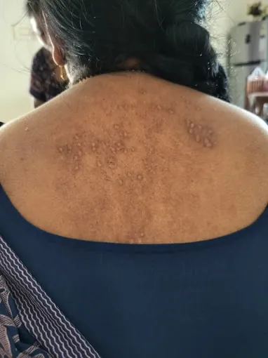 Image of: Dr Aarthi Sathishkumar Auroraa Skin In Ashok Nagar