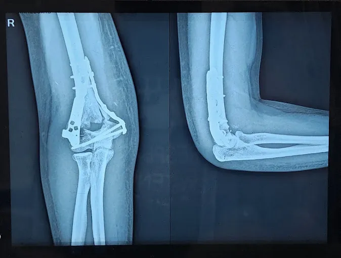 Image of: Dr Arun Kannan Best Orthopedic In Chennai