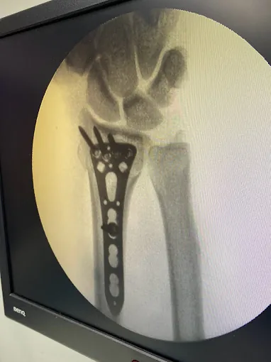 Image of: Dr Hemanths Bone And Joint In Perambur 2
