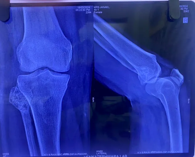 Image of: Dr Hemanths Bone And Joint In Perambur 3