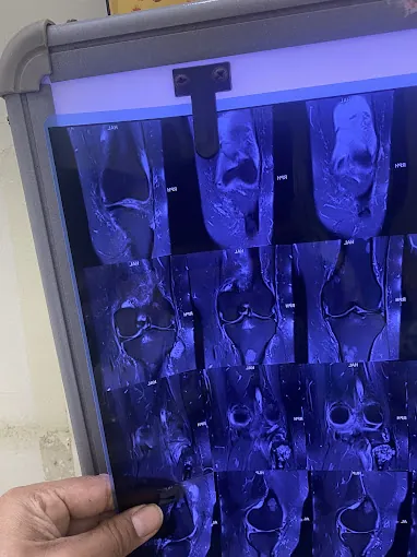 Image of: Dr Hemanths Bone And Joint In Perambur