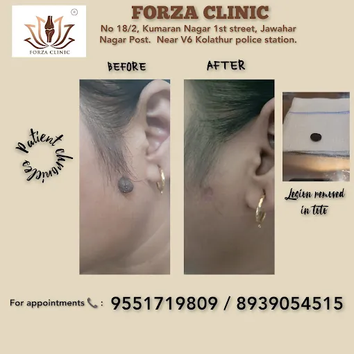 Image of: Dr Mayuri Chandrasekhar Dermatologist In Chennai 2