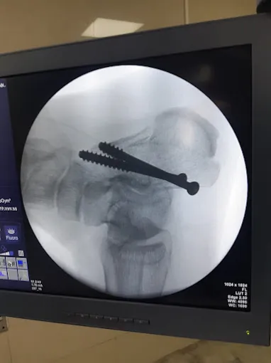 Image of: Dr Rakesh Shetty Sr Ortho In Chennai