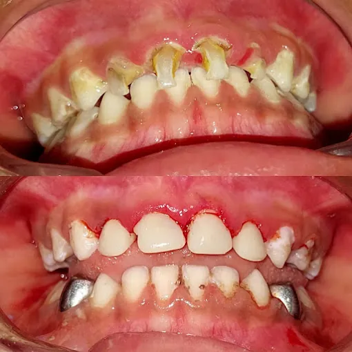 Image of: Kannmani Dentalhome In Chennai