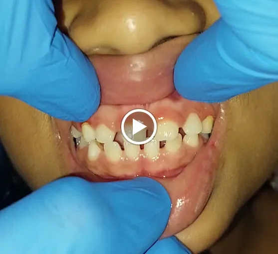Image of: Kannmani Dentalhome In Chennai 2