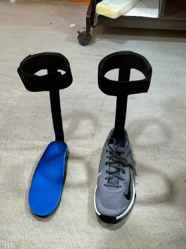 Image of: Kare Prosthetics And Orthotics In Kilpauk 3