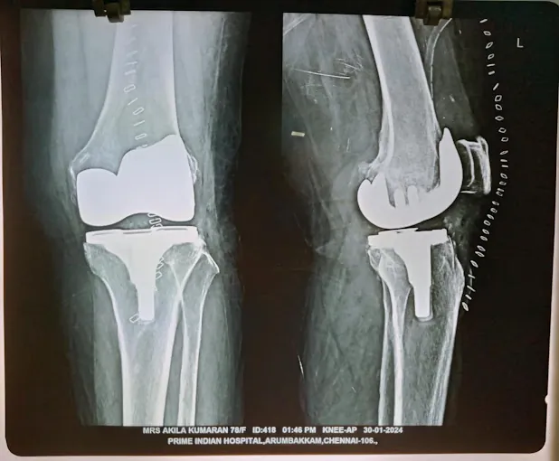Image of: Kishore Ortho Multi Super Speciality In Virugambakkam 3