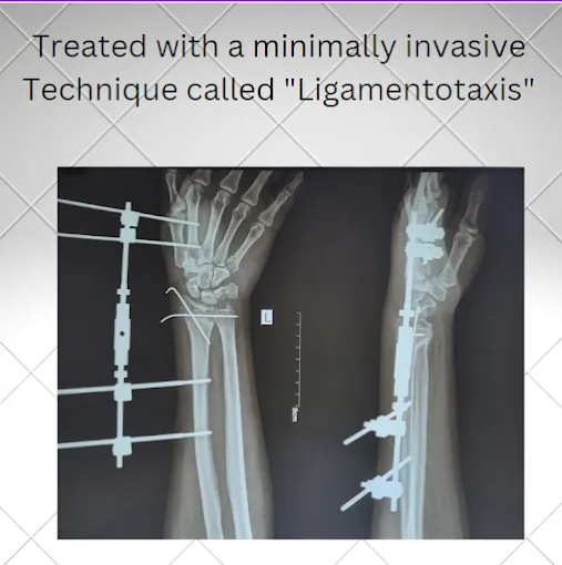 Image of: Kl Ortho Care Clinic In Chennai