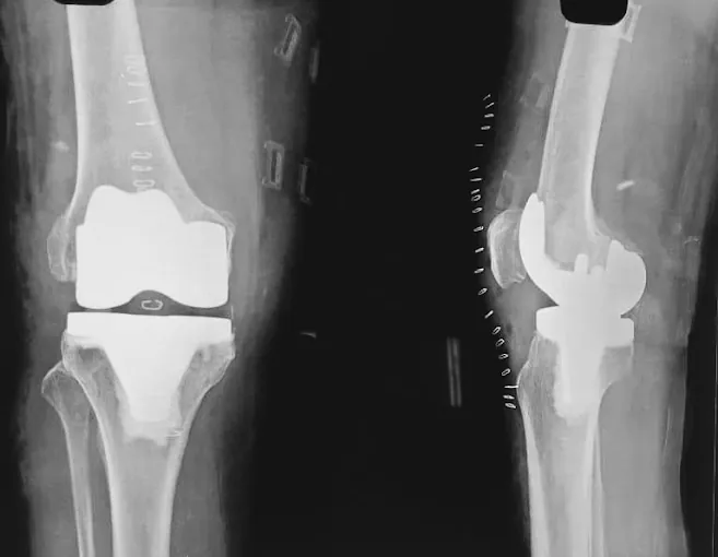 Image of: Ks Bone And Joint Clinicortho In Chennai