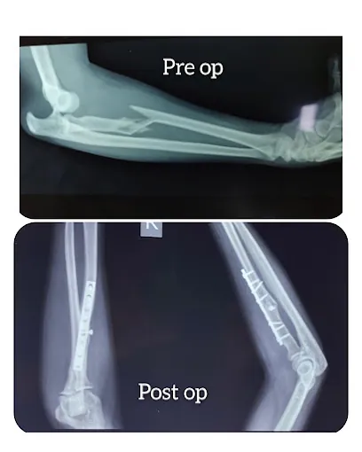 Image of: S2 Ortho Clinic In Velachery