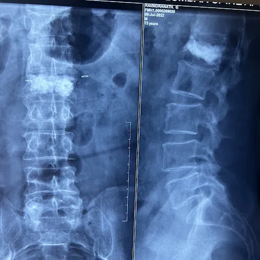 Image of: Spine And Joint Care In Avadi