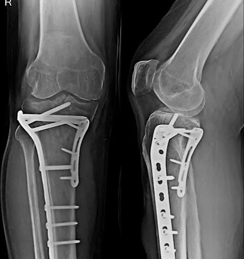 Image of: Spine And Joint Care In Avadi 3