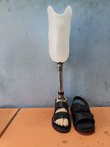 Image of: Vikkiraman Prosthetic And Orthotic Service In Chennai