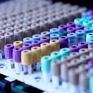 Image of: Hitech Labs Blood Test In Thiruvanmiyur 3