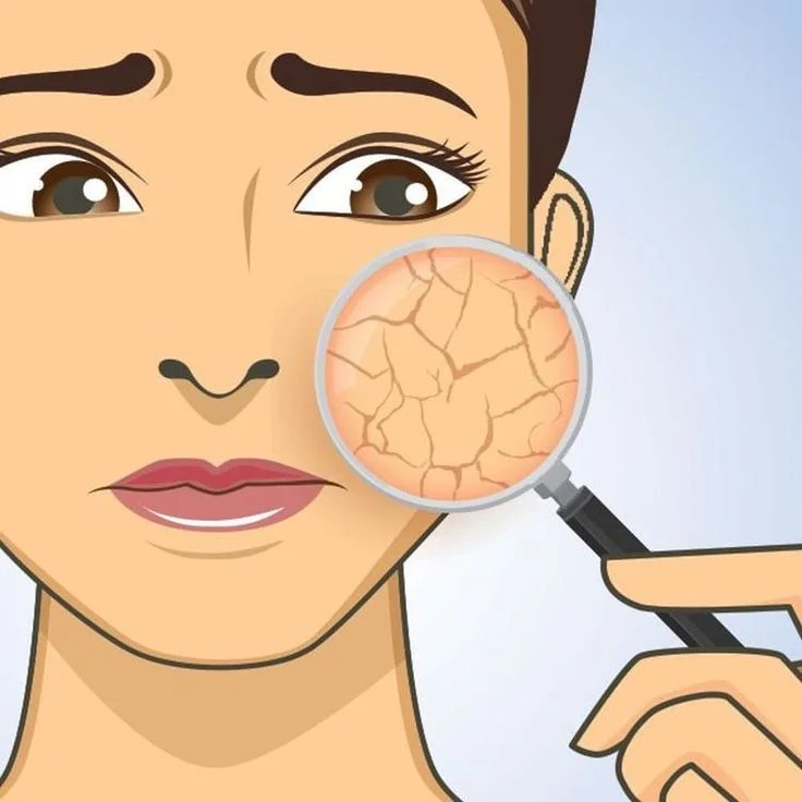 Skin Type Test